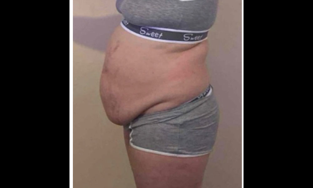 Before Transformation 1