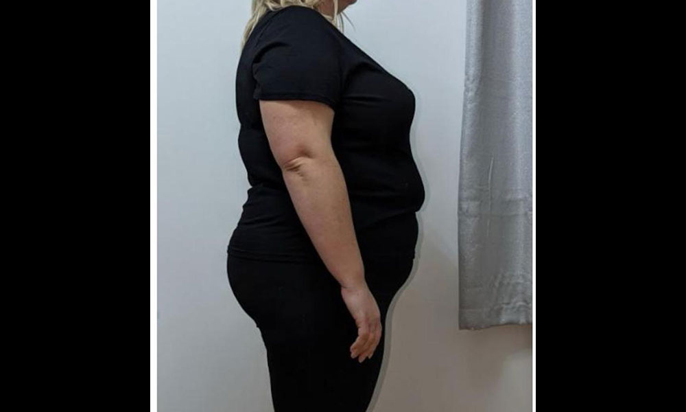 Before Transformation 3